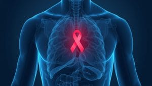 Prostate Cancer Drug Combination Shows Survival Benefit in Phase 3 Trial