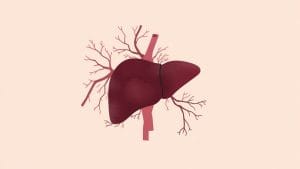 New England Journal of Medicine Publishes Images on Liver Condition Linked to Heart Valve Problem