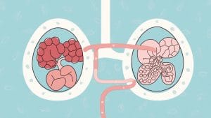 Prostate Cancer Drug Trial Shows Promise Before and After Surgery, Journal Reports