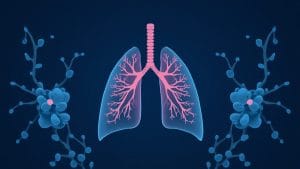 New Lung Cancer Drug Shows Promise as First-Line Treatment, Says Research