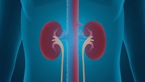 New Emergency Kidney Treatment Technique Shown in Medical Video