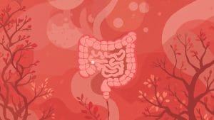 Bowel Cancer Screening: What the New England Journal of Medicine's Latest Guidance Covers