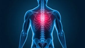 New Drug Trial Offers Hope for Patients with a Painful Muscle Condition
