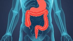 New Drug Trial Shows Promise for Bowel Condition Ulcerative Colitis