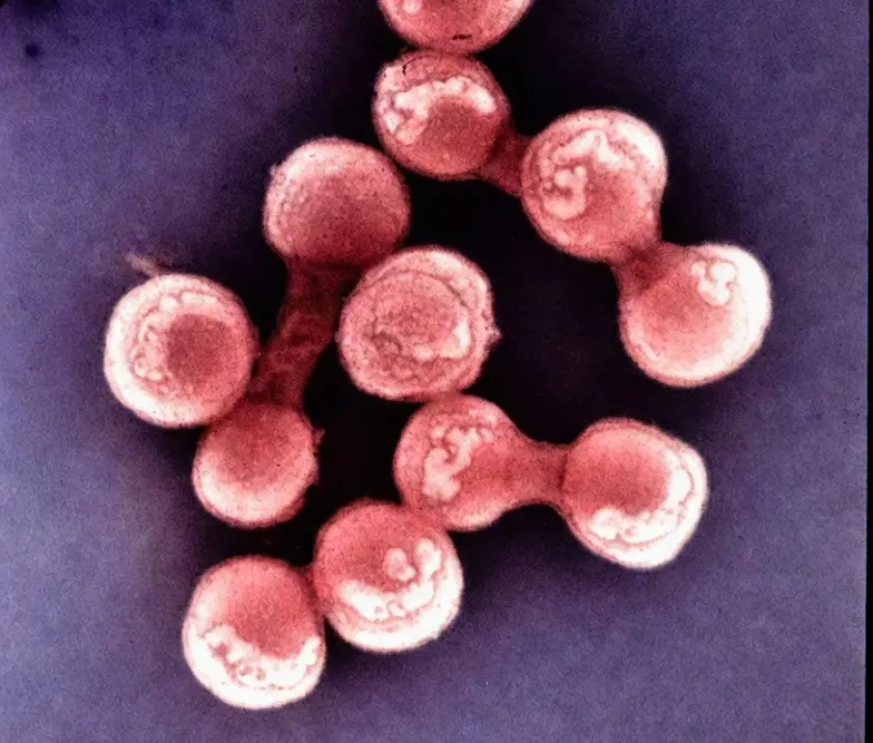 Kent Local News image